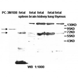 ABCG1 Antibody