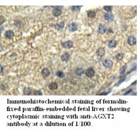 AGXT2 Antibody
