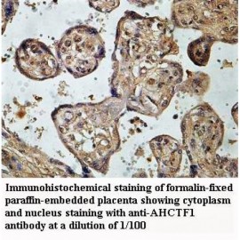 AHCTF1 Antibody