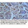 AHCYL2 Antibody