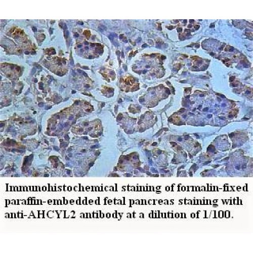 AHCYL2 Antibody