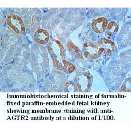 AGTR2 Antibody