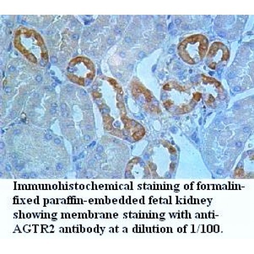 AGTR2 Antibody