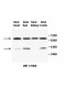 AGTR2 Antibody