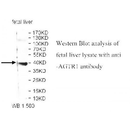 AGTR1 Antibody