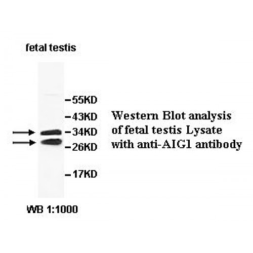 AIG1 Antibody
