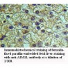 AIM1L Antibody