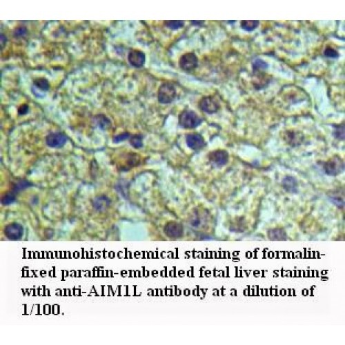 AIM1L Antibody