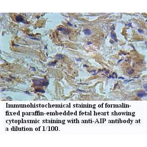 AIP Antibody