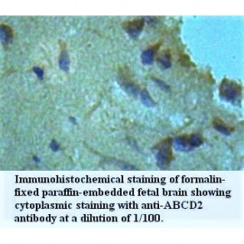 ABCD2 Antibody