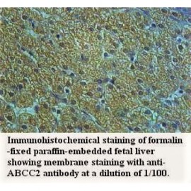 ABCC2 Antibody