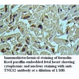 TNKS2 Antibody