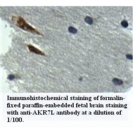 AKR7L Antibody