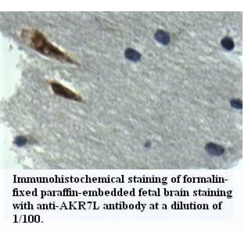 AKR7L Antibody