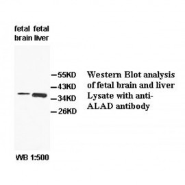 ALAD Antibody