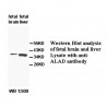 ALAD Antibody