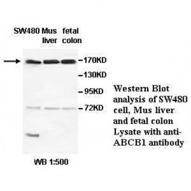 ABCB1 Antibody