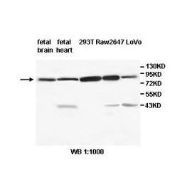 TRIM3 Antibody