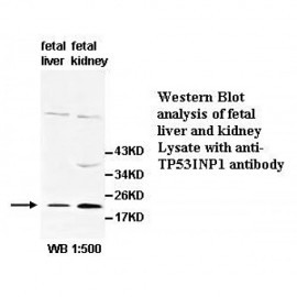TP53INP1 Antibody
