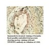 TP53INP1 Antibody