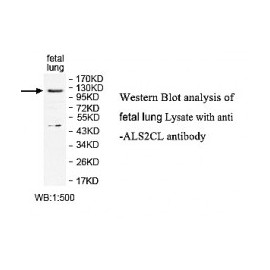 ALS2CL Antibody