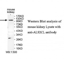 ALS2CL Antibody