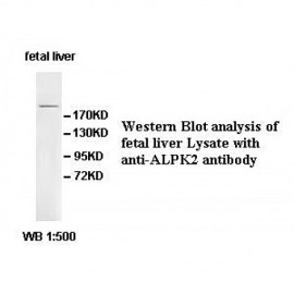 ALPK2 Antibody