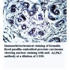 ALPK3 Antibody