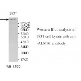 ALMS1 Antibody