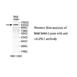 ALPK1 Antibody