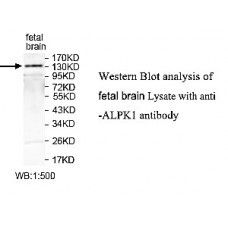ALPK1 Antibody