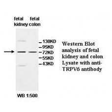 ALMS1 Antibody