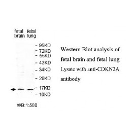  CDKN2A Antibody