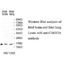  CDKN2A Antibody