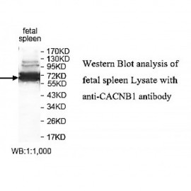 CACNB1 Antibody