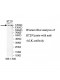 ALK Antibody