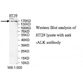 ALK Antibody