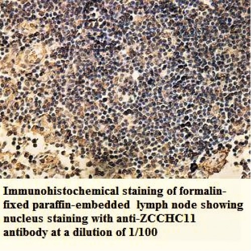 ZCCHC11 Antibody