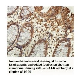 ALK Antibody