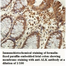 ALK Antibody
