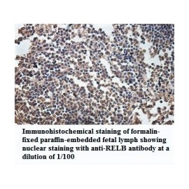RELB Antibody