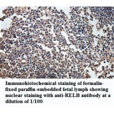 RELB Antibody