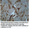 ASPN Antibody