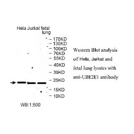 UBE2E1 Antibody