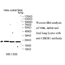 UBE2E1 Antibody