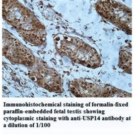 USP14 Antibody