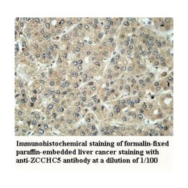 ZCCHC5 Antibody