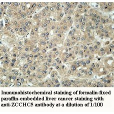 ZCCHC5 Antibody