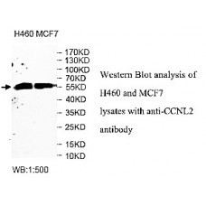 ADAMTS14 Antibody