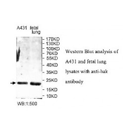 ADAMTS14 Antibody